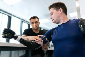 A Revolutionary Approach to Prosthetics That Move Like Real Limbs